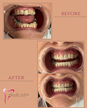 Slider image (8) Dr. Alejandra Rodarte Cosmetic & Implant Specialist